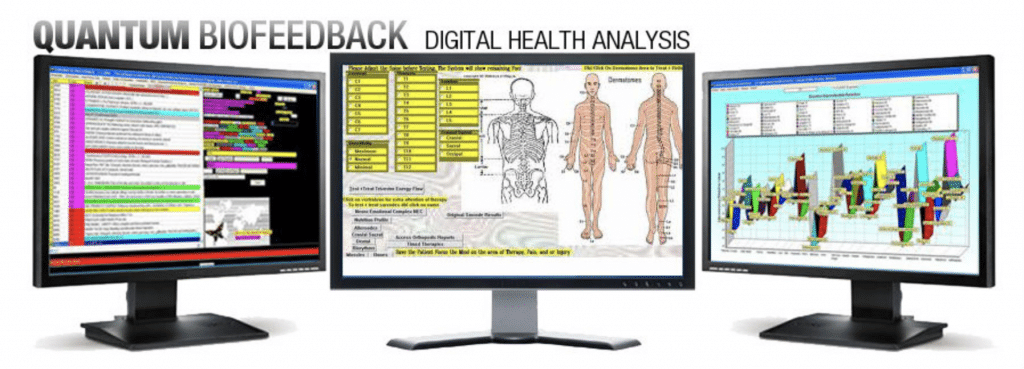 SCIO biofeedback screens shown on three computer screens